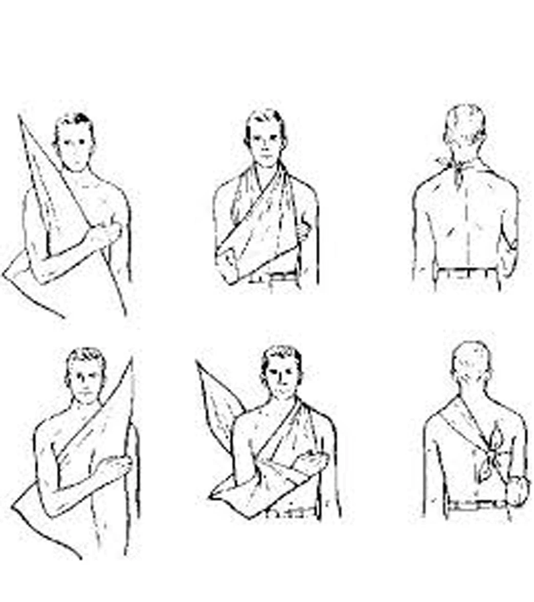 Triangular Bandage 2 Triangular Bandage - Image 2